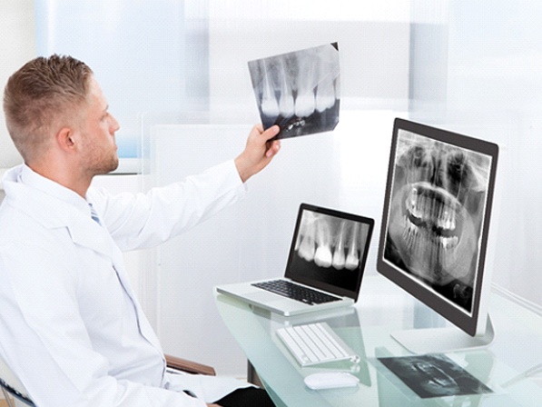 Dentist examining X rays of teeth