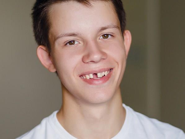 Young man with missing tooth smiling