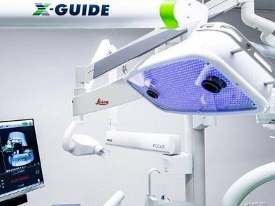 Xnav machine in dental office