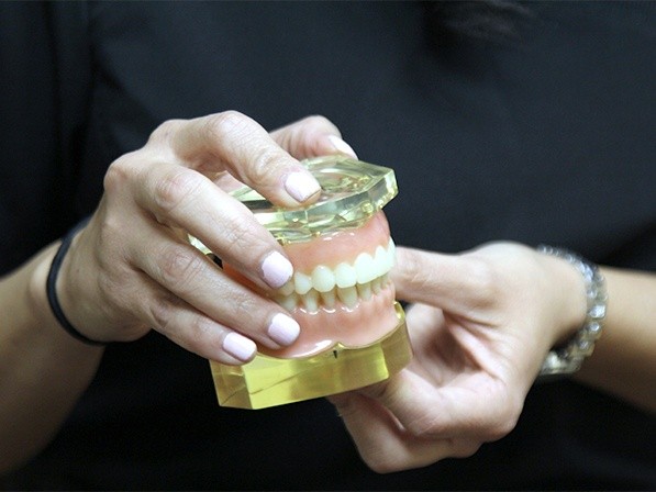 Closeup of model smile with custom dental implant supported denture