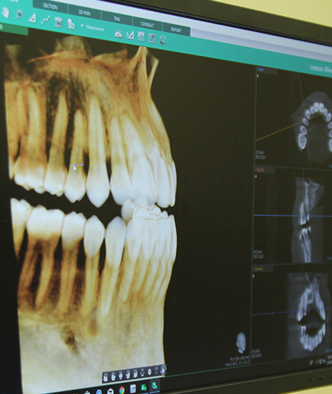 3 D image of patient's smile before oral surgery