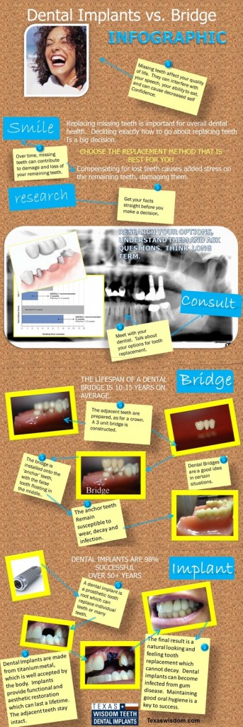 Dental Implant vs. Bridge Infographic